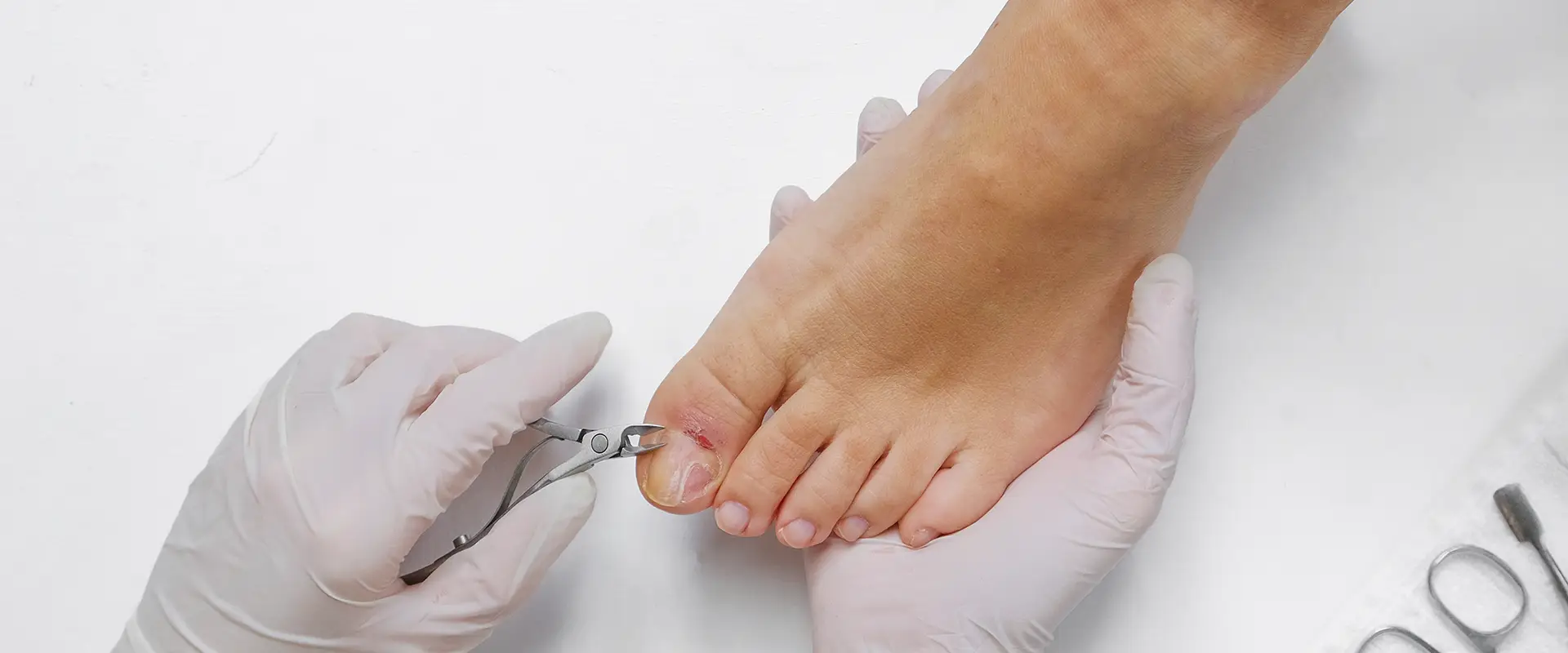 Servicios de Podología <br><b>Cuidamos la Salud de tus Pies</b>